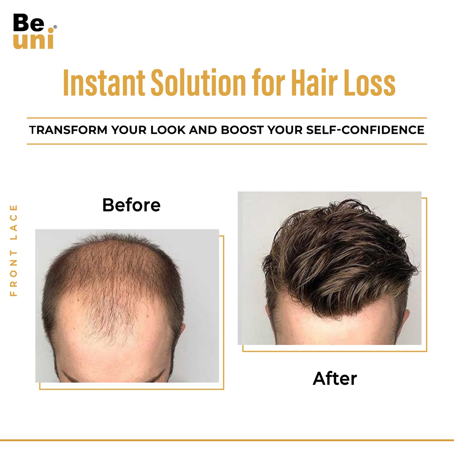 Beuni Front lace Hair patch for men | Hair wig for men | 100% natural human hair | Natural Hairline| Comfortable Lace Base | Black