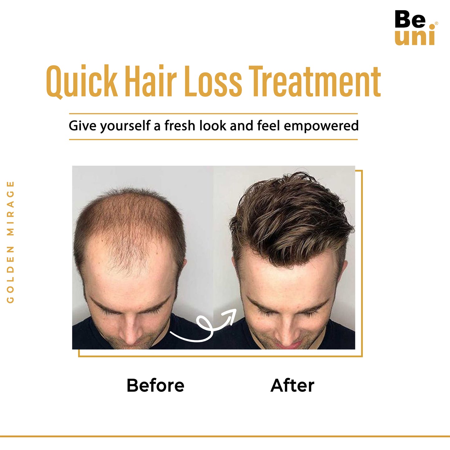 Beuni Golden Hair Miraj Hair Patch for Men-Natural Looking Slik Base Hair System/Patch/Toupee/Wig/Piece,Non Surgical Hair Replacement Solution -Black