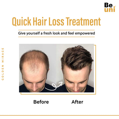 Beuni Golden Hair Miraj Hair Patch for Men-Natural Looking Slik Base Hair System/Patch/Toupee/Wig/Piece,Non Surgical Hair Replacement Solution -Black