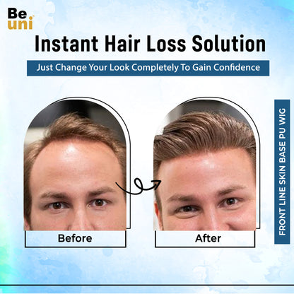 Beuni Frontal PU Skin Base Hair Patch for Invisible Frontline & Natural Coverage