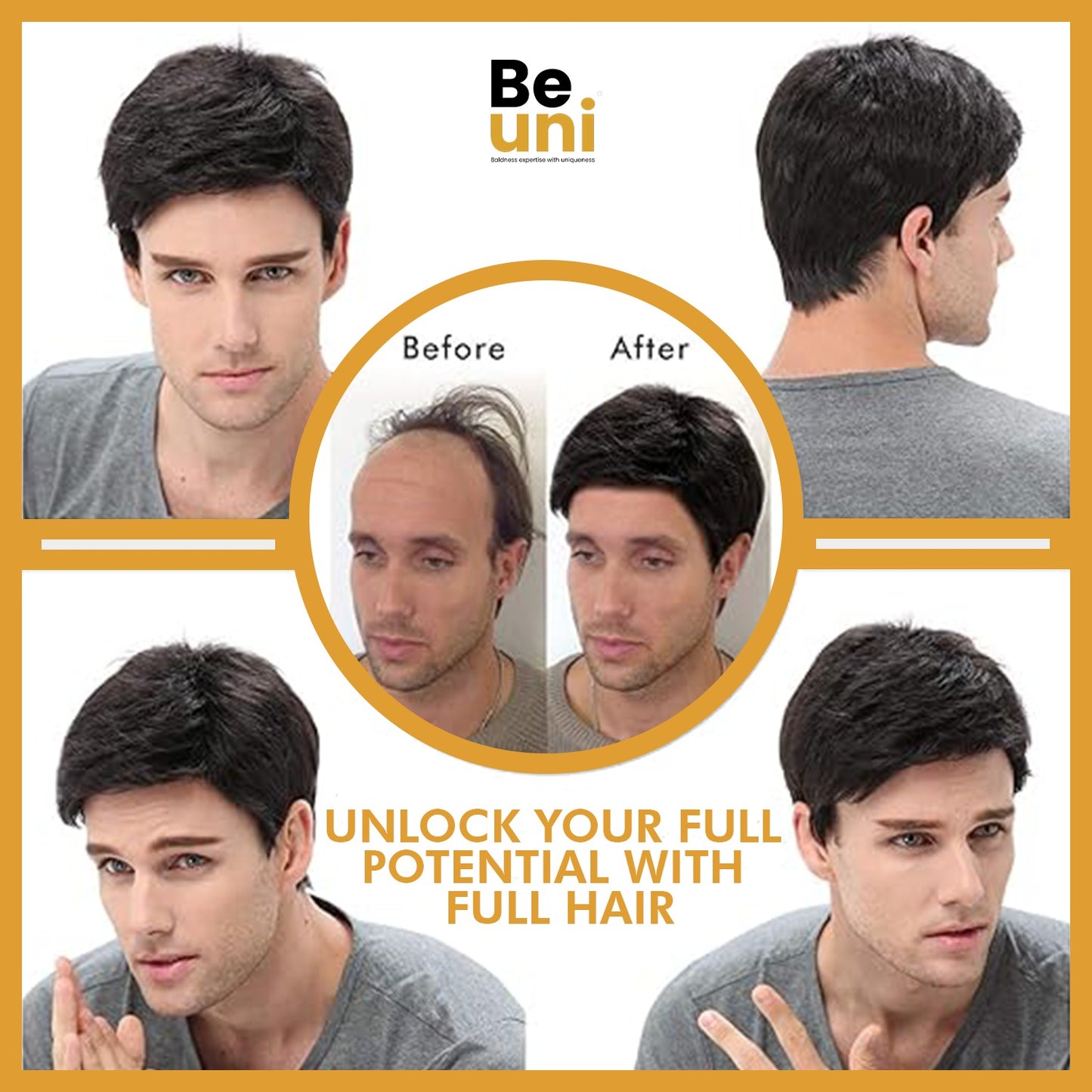 Beuni Smart Hair Patch for Men, Monofilament Apollo Mono Wig in 100% Natural Human Hair, Long Lasting Base Soft Fit (Colour: Natural Black)